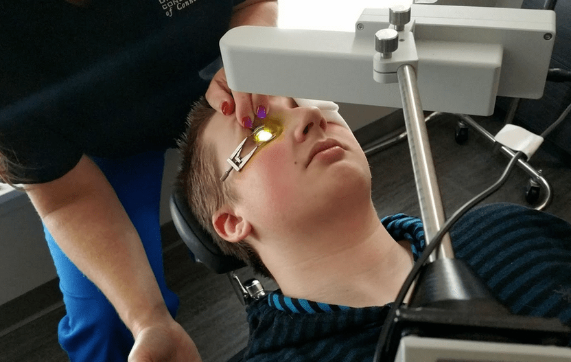 Cross-linking – corneal surgery for lesions