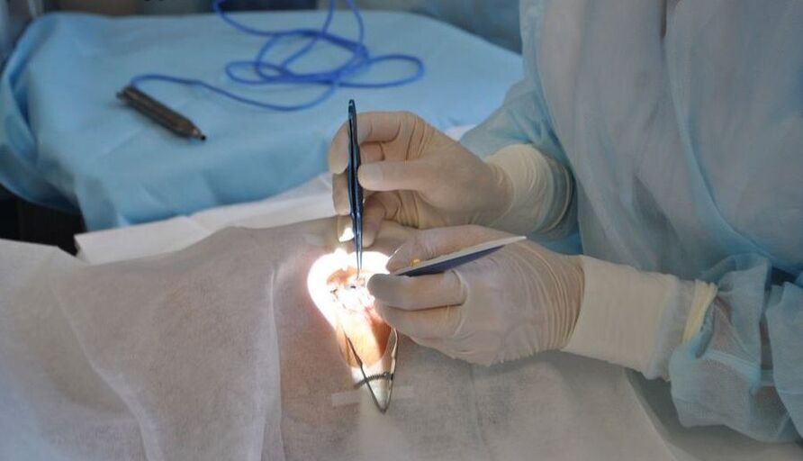 Eye surgery helps restore vision